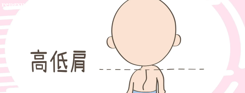 脊柱侧弯矫正器具佩戴注意事项有哪些?