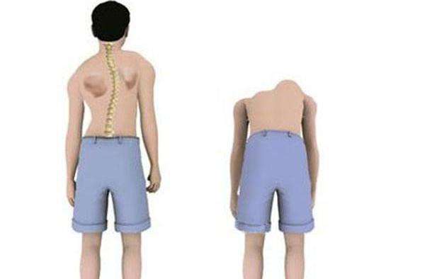 ��ɶ�ͯ���������ԭ������Щ��