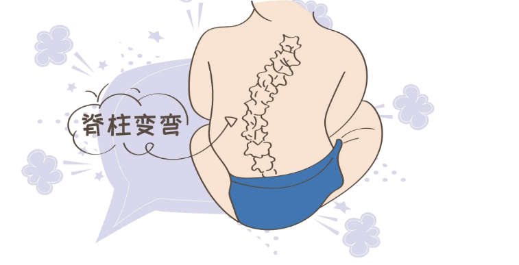 哪个阶段的脊柱侧弯的危害会越拖越严重?